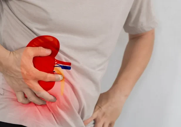 what can er do for kidney stones